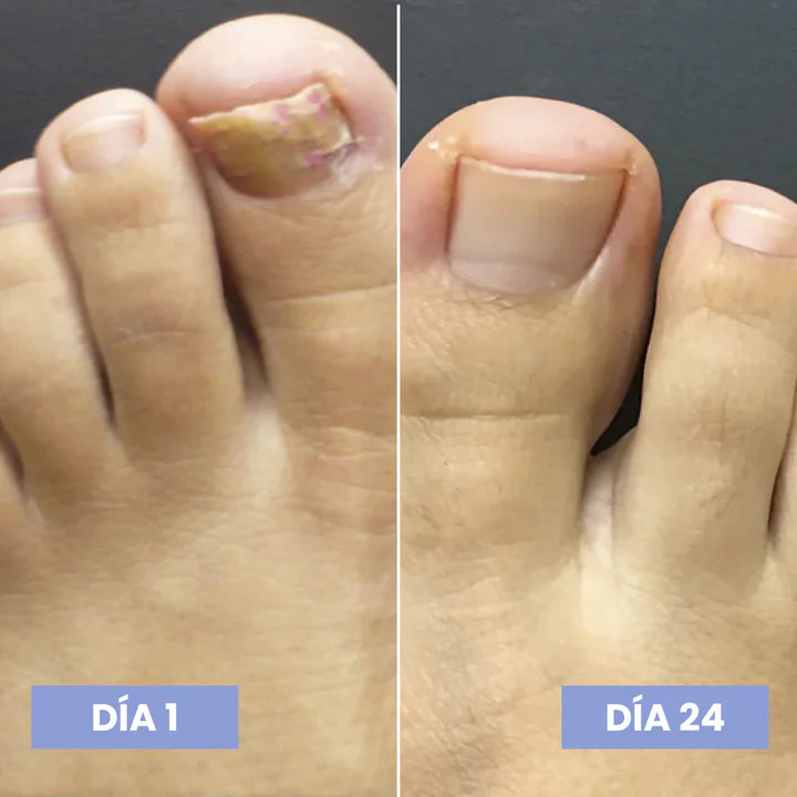 ¿Cansada de esconder tus uñas?